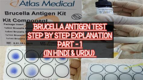 brucellosis testing procedures pdf